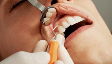 understanding dental insurance