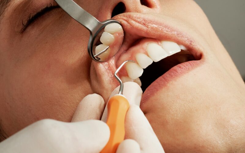 understanding dental insurance